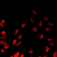 Anti-PLCXD2 Antibody