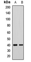 GNAI2 Rabbit Polyclonal Antibody