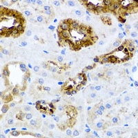 Anti-SHH Antibody