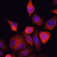 Anti-SHH Antibody