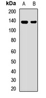 AE2 Rabbit Polyclonal Antibody