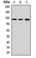 TRPC3 Rabbit Polyclonal Antibody