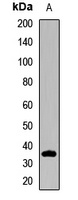 ELMOD2 Rabbit Polyclonal Antibody