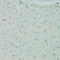 Anti-SAF-B1 Antibody