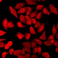 Anti-HELIC1 Antibody