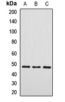 PDK3 Rabbit Polyclonal Antibody