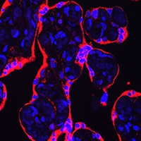 HSD3B1 antibody