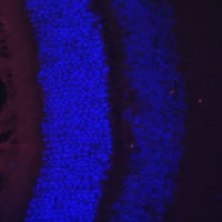 Anti-RDH5 Antibody