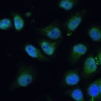 Anti-CPS1 Antibody