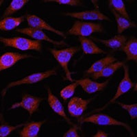 NEDD4L antibody