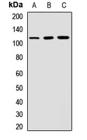 CD6 Rabbit Polyclonal Antibody