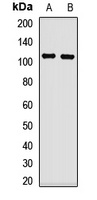 TRPC6 Rabbit Polyclonal Antibody