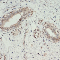 Anti-KDM6A Antibody