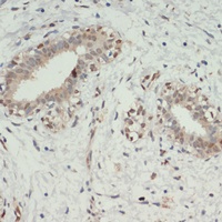 KDM6A antibody