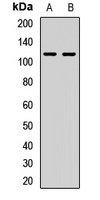 Semaphorin 4C Rabbit Polyclonal Antibody