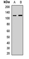 LLGL2 Rabbit Polyclonal Antibody
