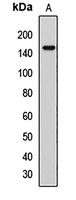 PALB2 Rabbit Polyclonal Antibody