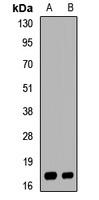 UBE2NL Rabbit Polyclonal Antibody