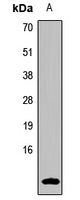 Uroguanylin Antibody