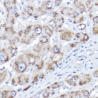 Anti-AGXT1 Antibody