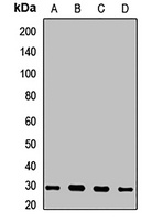Clathrin Light Chain B Rabbit Polyclonal Antibody