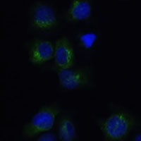 Clathrin Light Chain B Rabbit Polyclonal Antibody