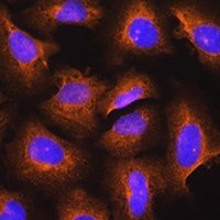 Anti-DSPP Antibody