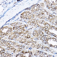 Anti-GNB2 Antibody