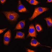 Anti-GNB2 Antibody