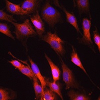 Anti-NEFH Antibody