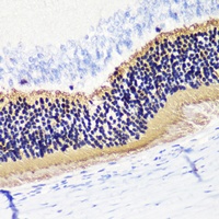 Anti-PDC Antibody