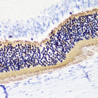 PDC antibody