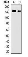 BSEP Rabbit Polyclonal Antibody