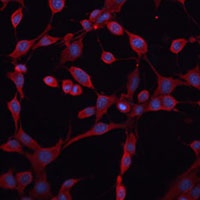 Anti-BSEP Antibody
