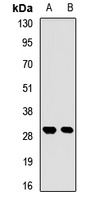 RPP30 Rabbit Polyclonal Antibody