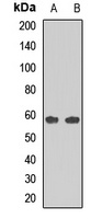 PRDM11 Rabbit Polyclonal Antibody