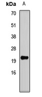 DNA Polymerase delta 4 Rabbit Polyclonal Antibody