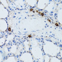 Anti-TEFM Antibody