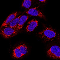 Anti-TEFM Antibody