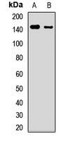ULK1 Rabbit Polyclonal Antibody