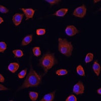 Anti-ULK1 Antibody