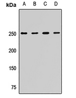 CKAP5 Rabbit Polyclonal Antibody