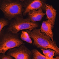CKAP5 Rabbit Polyclonal Antibody