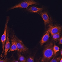 Anti-FcRn Antibody