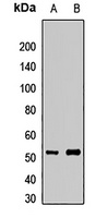 HOXA10 Rabbit Polyclonal Antibody