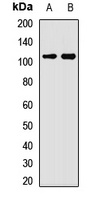 MSH4 Rabbit Polyclonal Antibody