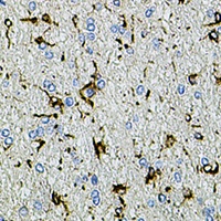 Anti-TRPA1 Antibody