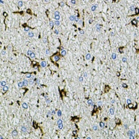 TRPA1 antibody