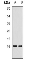 p16-ARC Rabbit Polyclonal Antibody