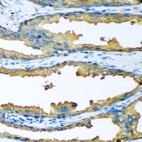 Anti-Cytochrome P450 46A1 Antibody